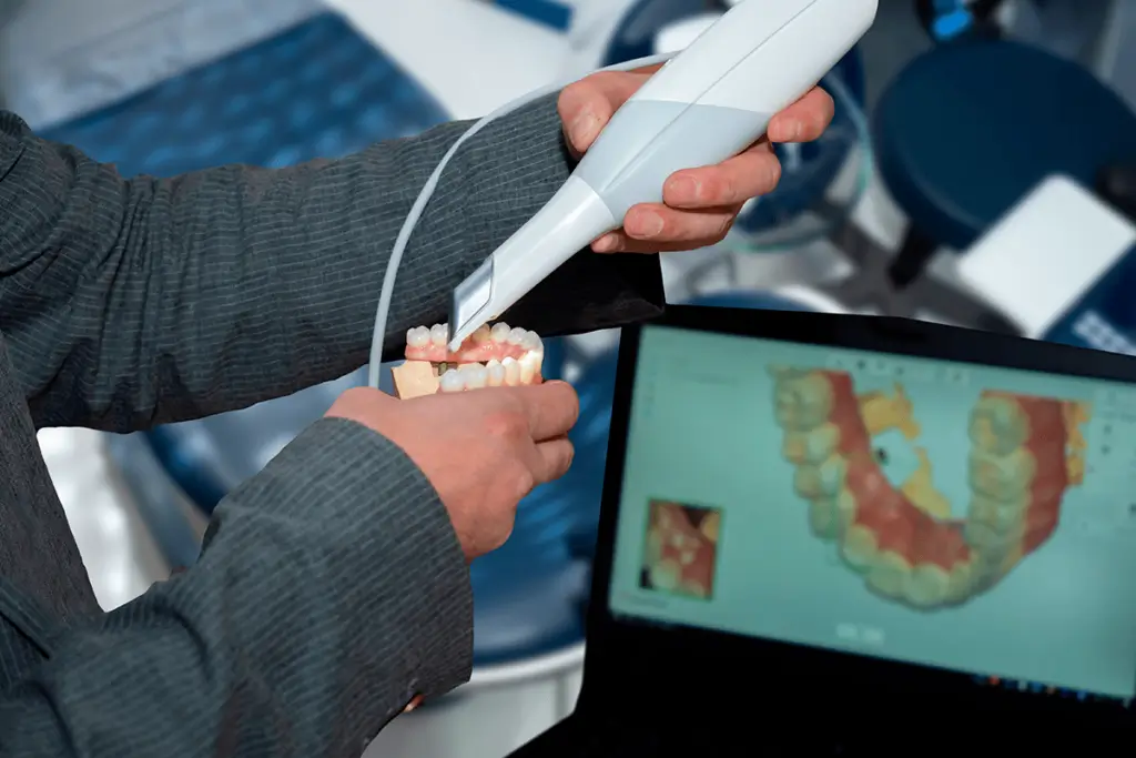 6 benefícios de usar um scanner intraoral na consulta