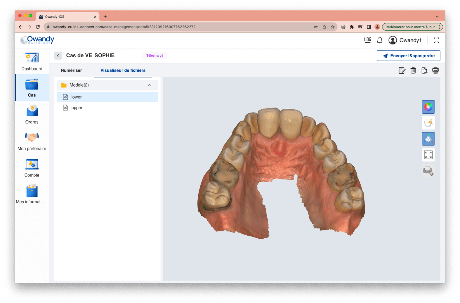 4-IOS-Intra-Oral-Scanner2