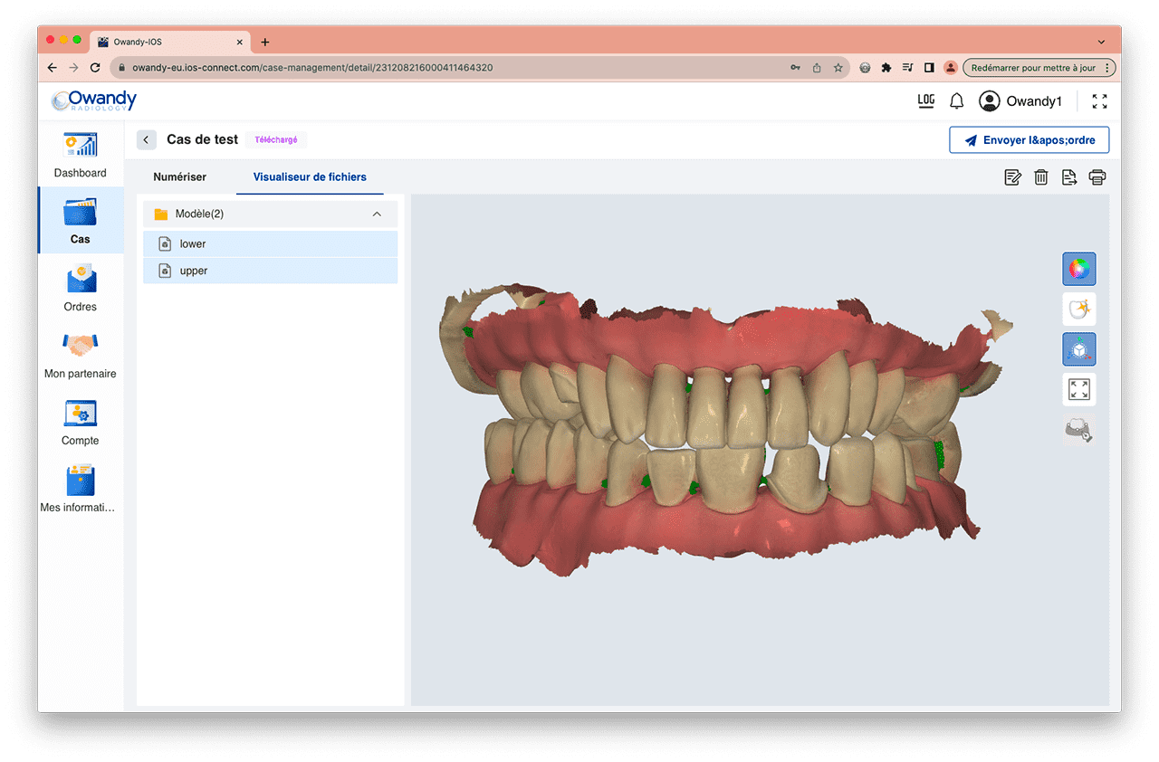 5-IOS-Intra-Oral-Scanner