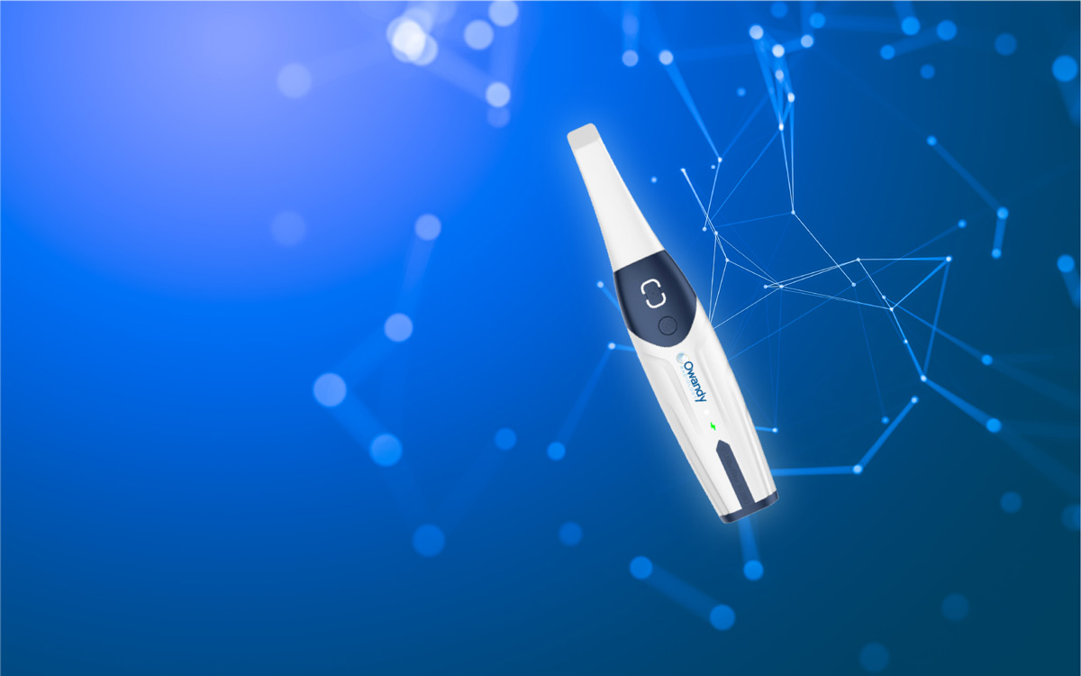 Owandy IOS: 4 vantagens do novo scanner intraoral